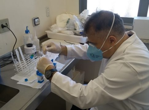 Módulo de Saúde da Agepen utiliza alta tecnologia para diagnóstico rápido e eficiente da tuberculose em detentos