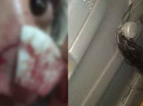 Marido atropela duas vezes, morde e arranca cabelos da mulher em MS