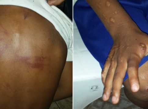 Mãe presa por tortura diz que agrediu menino ao vê-lo sofrendo tentativa de estupro