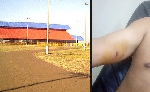‘Mandei ele pegar mesmo’ diz dono de pit bull que atacou homem no Jacques da Luz