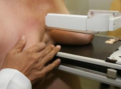 Entra em vigor lei que garante ultrassonografia mamária pelo SUS a mulheres jovens