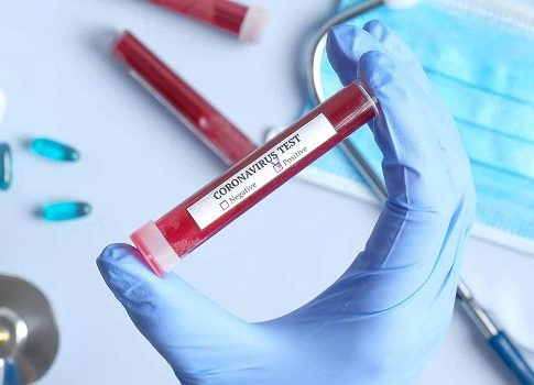 Coronavírus: SES redireciona recursos de R$ 12,5 milhões para combate à pandemia
