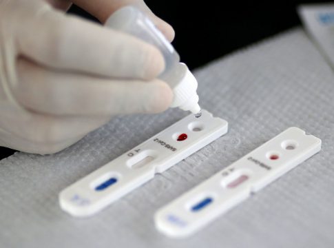 Butantan busca desenvolver vacina alternativa contra covid-19