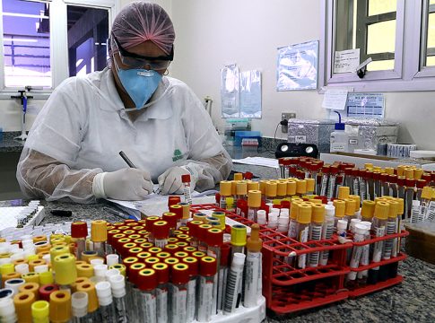 Mato Grosso do Sul registra 274 casos confirmados de coronavírus e monitora 50 suspeitos