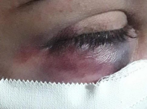 Dia das mães já passou: filho espanca mulher com cadeiradas e ameaça de morte na frente da PM