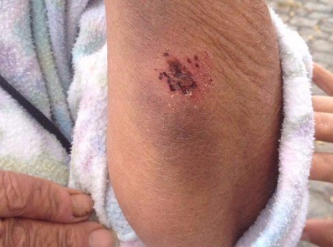 Idosa de 67 anos é agredida por quatro homens encapuzados na saída de bar