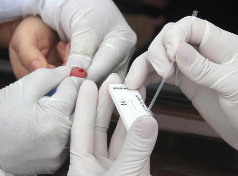 Teste rápido de coronavírus custa R$ 140 e ainda é escasso em farmácias de MS