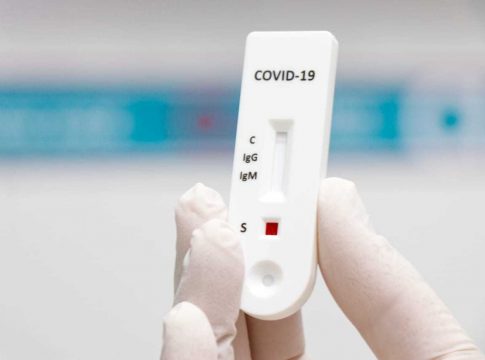 Lei sancionada dá prioridade a profissionais essenciais para testes de covid-19
