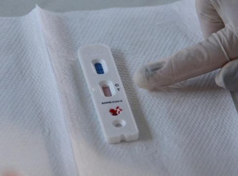 Brasil tem 22.048 novos casos e 703 óbitos de Covid-19 nas últimas 24 horas