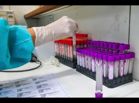 Taxa de transmissão da Covid-19 no Brasil cai para 1,01, mostra estudo