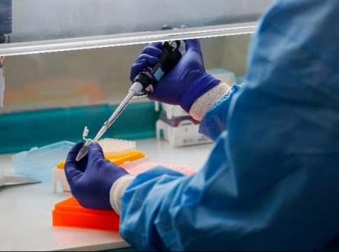 País registra 494 mortes por Covid-19 em 24 horas; total chega a 114.744