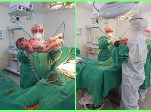 Médico faz parto de mãe com coronavírus e bebê nasce sem a doença em MS