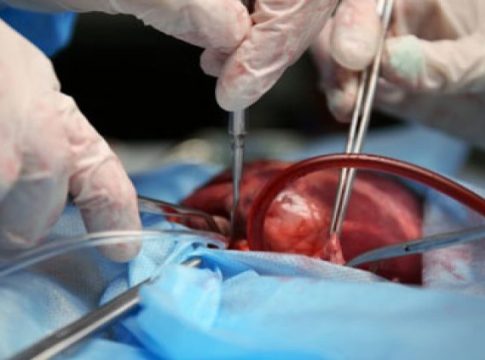 Cem sul-mato-grossenses renasceram com transplante de órgãos em 2020 e Setembro Verde sensibiliza para o tema