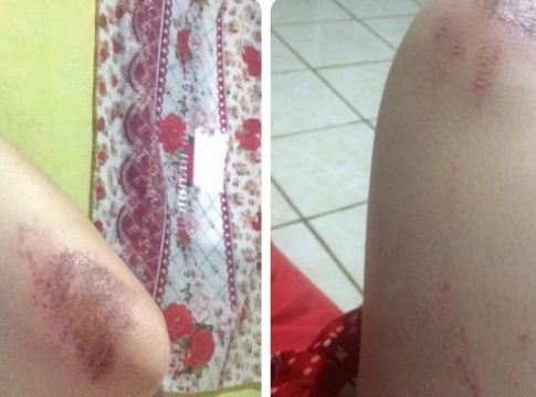 ‘Não consigo mais sair sozinha para nada’, diz jovem agredida em roubo no Tijuca