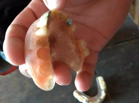 Idoso morre de covid e dentes de ouro de R$ 12 mil são furtados de prótese