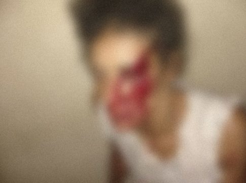 Garota de programa é espancada em ‘casa das primas’, foge e pede ajuda na polícia