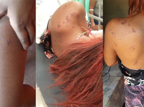 Adolescente de 14 anos é arrastada e atropelada após mulher desconfiar de suposto caso de marido