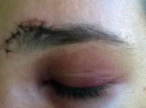Bebê é agredido por padrasto, mãe vai defender e acaba levando socos no rosto