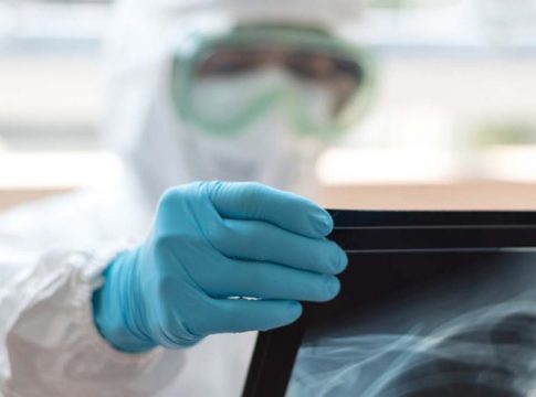 Mesmo após ‘cura’, covid deixa cascata de inflamação e médicos alertam pacientes em MS