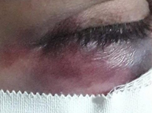Vizinhos ouvem gritos de socorro, invadem casa e salvam mulher espancada por marido