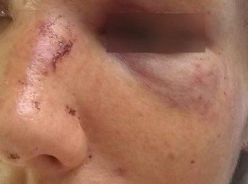 Ao se negar a fazer sexo com marido, mulher é espancada a socos e arrastada pelos cabelos