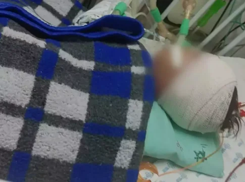 “Não tem mais volta”, diz avó sobre morte encefálica de bebê espancado