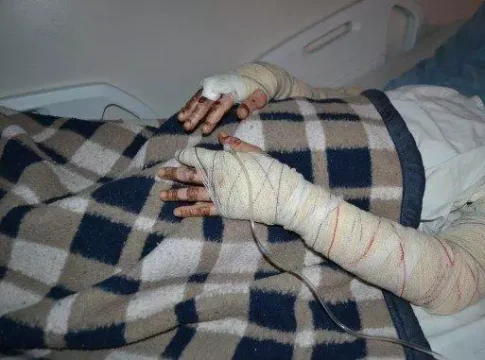 Namorado tranca porta de casa, joga gasolina e ateia fogo em corpo de mulher