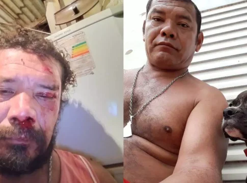 Onça matou dois cachorros antes de atacar homem em Corumbá: ‘Medo? Nada’