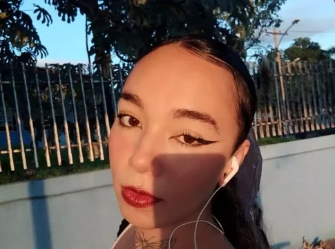 Jovem que perdeu perna em acidente de moto corre risco de nova amputação