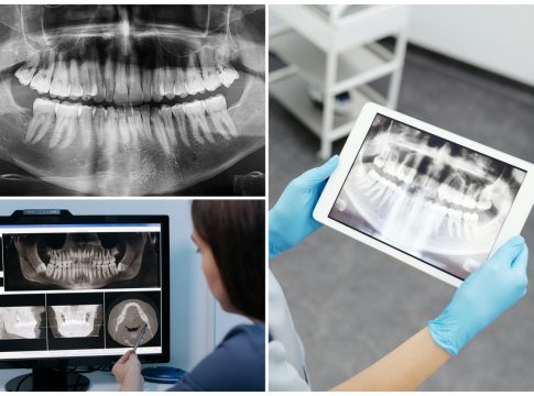 Prefeitura recebe novo RX panorâmico para a Odontologia Municipal de Naviraí