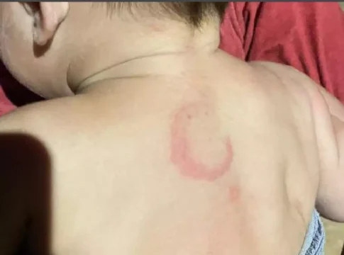 Preso por espancar bebê já havia sido detido por agredir companheira grávida