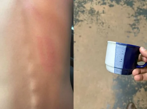 Criança de dez anos é agredida com golpes de xícara por aluno mais velho em colégio de Campo Grande