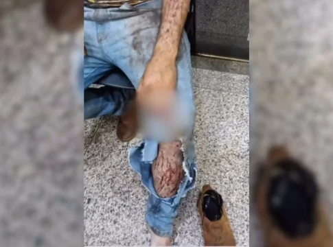 Morador diz ter sido atacado por onça enquanto trabalhava na colheita em Ponta Porã